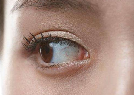 邢臺(tái)割眼袋醫(yī)生