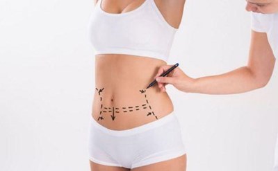 杭州復合彩光去曬斑醫(yī)生