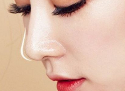 青島眼細(xì)紋消除醫(yī)生