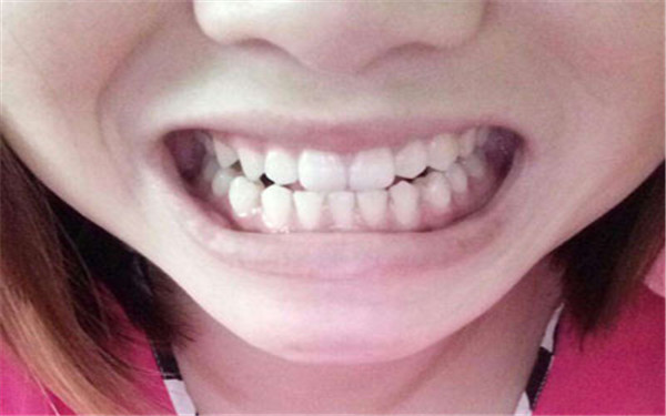 聊城脂肪抬頭紋填充醫(yī)生