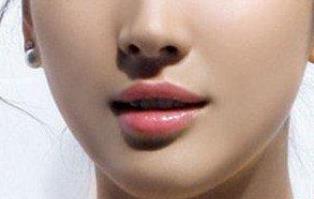 東莞祛動(dòng)態(tài)細(xì)紋手術(shù)醫(yī)生