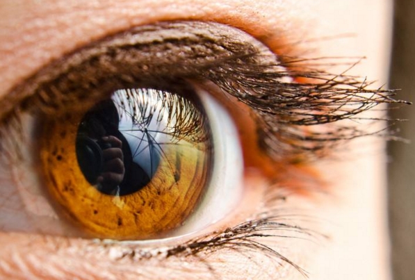 中山激光去除眼底紋醫(yī)生