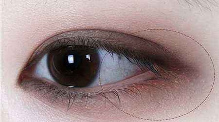 大連內(nèi)雙開雙眼皮醫(yī)生