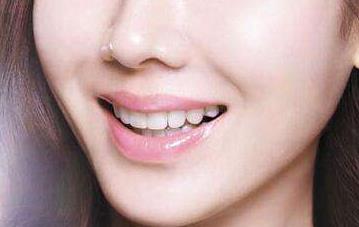 杭州線雕改善蘋果肌醫(yī)生