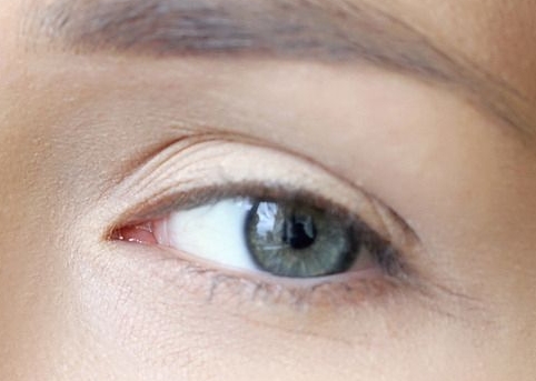 大慶上眼角提升手術(shù)醫(yī)生