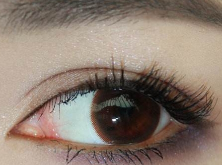 咸陽面部色素斑醫(yī)生