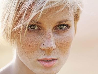 濱州膠原蛋白去口周紋醫(yī)生