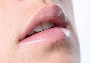 烏魯木齊治療嬰胎記醫(yī)生