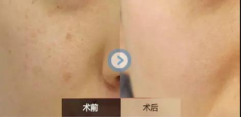 沈陽(yáng)美膚祛斑醫(yī)生