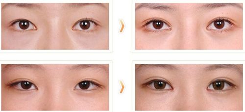 杭州瘦腿針注射醫(yī)生