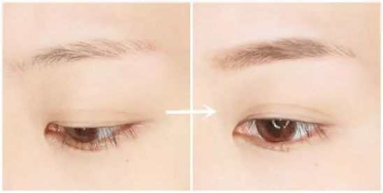 無(wú)錫面部年輕精細(xì)手術(shù)醫(yī)生