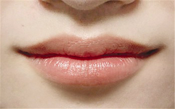 山東微整祛疤醫(yī)生