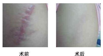 衡陽面部削骨醫(yī)生