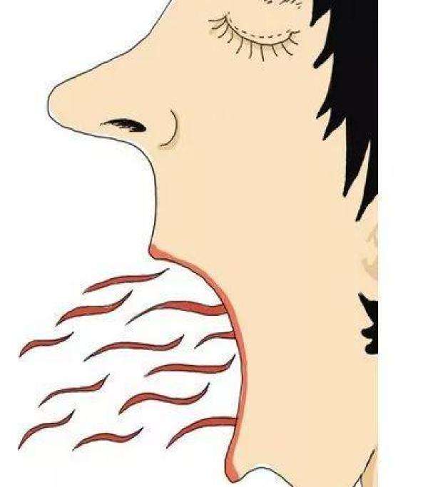 蕪湖射頻祛除眼角紋醫(yī)生