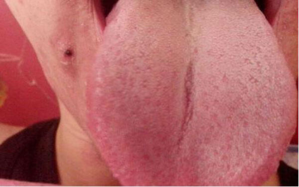 眉山蘋(píng)果肌線(xiàn)雕醫(yī)生