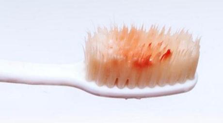 西安熱瑪吉消除眼部細(xì)紋醫(yī)生