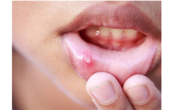 長沙內(nèi)吸去眼袋醫(yī)生