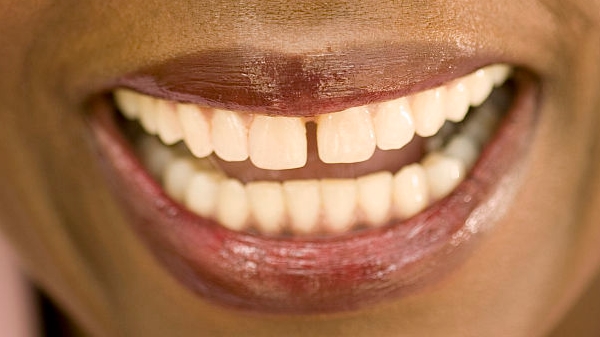 上海微雕去頸部皺紋醫(yī)生