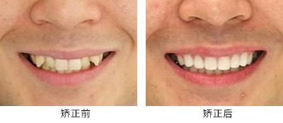湖南綜合實(shí)力最強(qiáng)的整形醫(yī)院排行榜：這十家業(yè)內(nèi)知名醫(yī)院等你探尋！