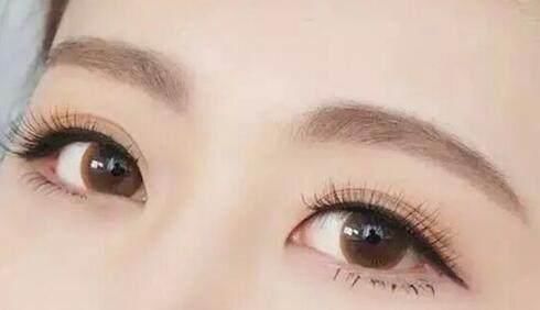 廈門(mén)眉間紋填充脂肪醫(yī)生