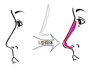 深圳最佳激光脫毛整形醫(yī)院推薦-公立醫(yī)院領(lǐng)跑市場！