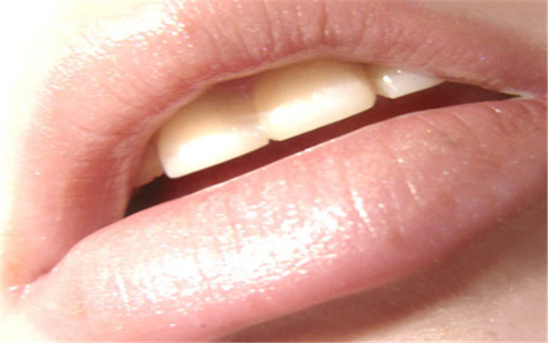 長(zhǎng)沙霧化填充川字紋醫(yī)生