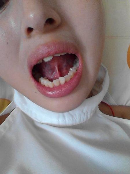 昆明填充自體脂肪醫(yī)生