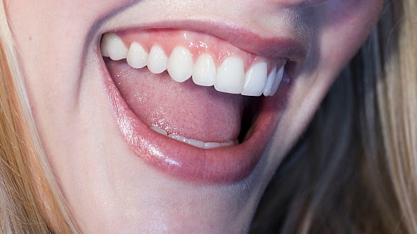 云南去雙下巴手術醫(yī)生