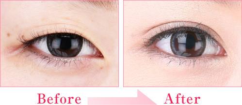 濟南激光治療老年斑醫(yī)生