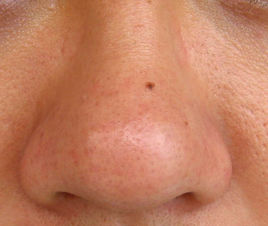 廣安線雕動態(tài)細(xì)紋醫(yī)生