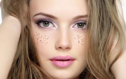 泉州鼻部再造術醫(yī)生