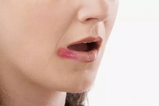 四川玻尿酸祛川字紋醫(yī)生