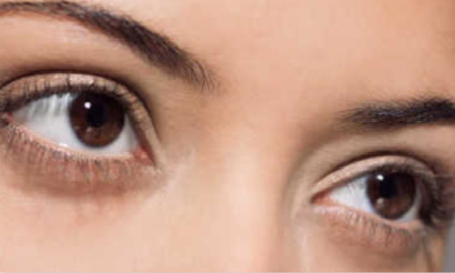 長(zhǎng)沙光子嫩膚治療妊娠斑醫(yī)生