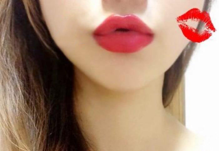 寧波E光治療痤瘡醫(yī)生