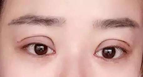 北京360度分層吸脂塑身術(shù)醫(yī)生