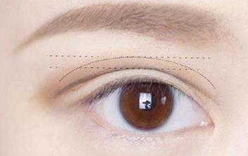 廣州畸形鼻矯正醫(yī)生