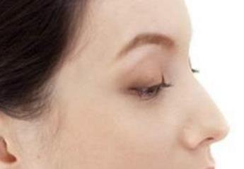 寧波玻尿酸面部精細化美學(xué)注射醫(yī)生