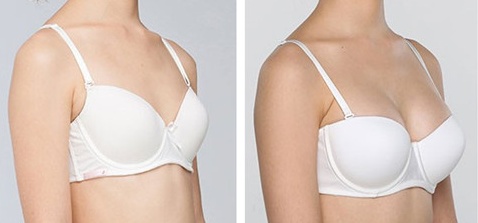 淮北光子嫩膚去痘坑醫(yī)生