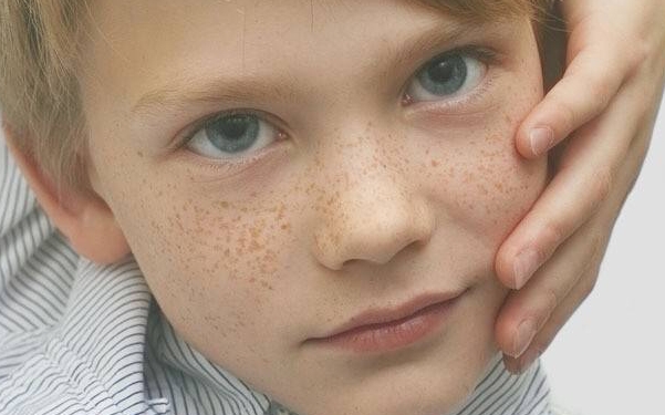 北京超皮秒去痘印醫(yī)生