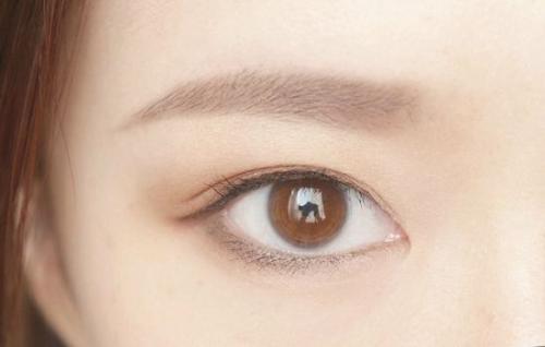 承德祛木偶紋醫(yī)生