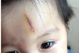 上海自體脂肪隆胸醫(yī)院排行榜優(yōu)選五佳口碑機(jī)構(gòu)！