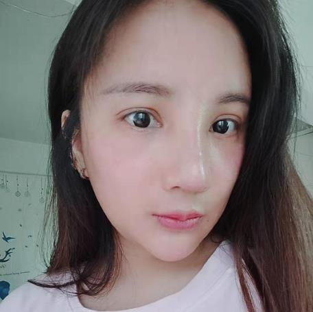 天津文怡整形水光針效果分享，化出來的好皮膚不如真的好皮膚