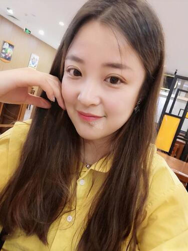 西安時光整形郭淑華雙眼皮案例分享，一個月就這么自然