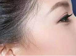 北京市中西醫(yī)結(jié)合醫(yī)院醫(yī)學(xué)整形美容中心玻尿酸豐太陽穴