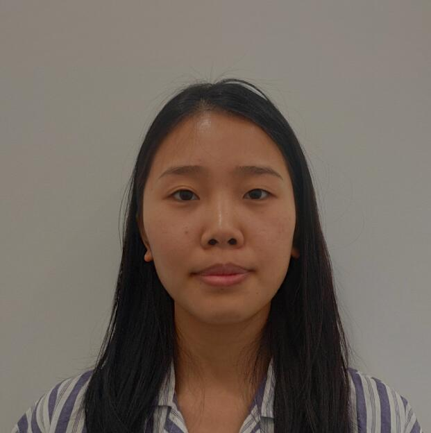 煙臺(tái)華怡整形張上海切開雙眼皮案例分享