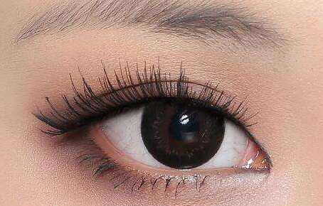 福州新時(shí)代美容雙眼皮術(shù)后效果