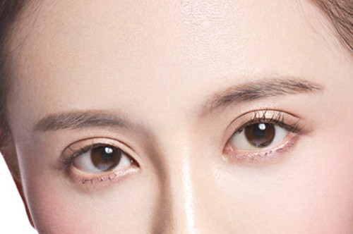 菏澤華美整形美容醫(yī)院開內(nèi)眼角術后效果