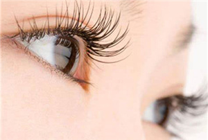 杭州靜港醫(yī)療美容診所開眼角術后效果