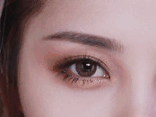 杭州格萊美整形醫(yī)療美容整形醫(yī)院開眼角術(shù)后效果