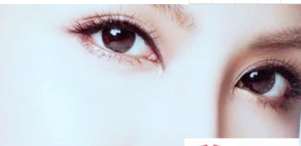 淮北天煌美容整形醫(yī)院開(kāi)內(nèi)眼角